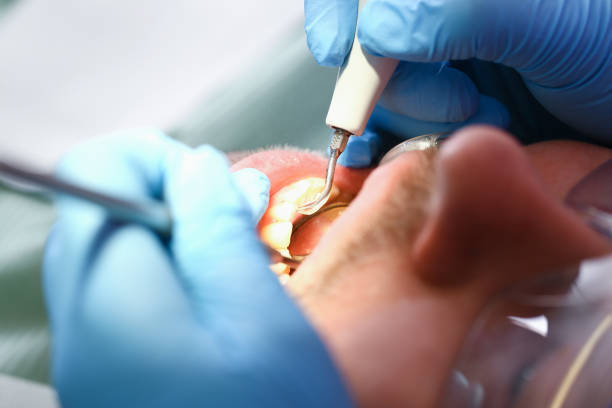 Best Emergency Dental Care for Trauma or Injury in Colona, IL